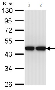 Western blot - Anti-ACTL8 antibody (AB96756), expandable thumbnail