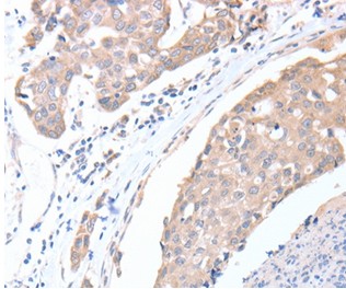 Immunohistochemistry (Formalin/PFA-fixed paraffin-embedded sections) - Anti-ACTL8 antibody - C-terminal (AB197831)