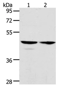 Western blot - Anti-ACTL8 antibody - C-terminal (AB197831)
