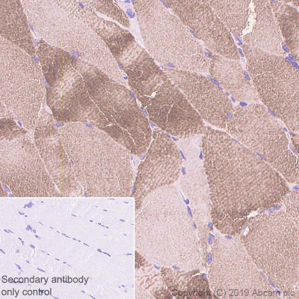 Immunohistochemistry (Formalin/PFA-fixed paraffin-embedded sections) - Anti-ACTN3 antibody [EP2531Y] - BSA and Azide free (AB247376), expandable thumbnail
