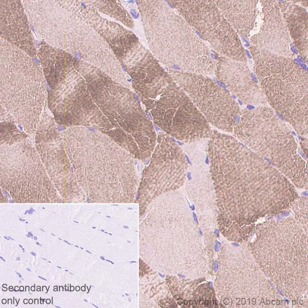 Immunohistochemistry (Formalin/PFA-fixed paraffin-embedded sections) - Anti-ACTN3 antibody [EP2531Y] - BSA and Azide free (AB247376)