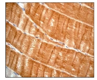Immunohistochemistry (Formalin/PFA-fixed paraffin-embedded sections) - Anti-ACTN3 antibody [EP2531Y] - Loading Control (ab68204), expandable thumbnail