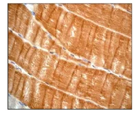 Immunohistochemistry (Formalin/PFA-fixed paraffin-embedded sections) - Anti-ACTN3 antibody [EP2531Y] - Loading Control (AB68204)