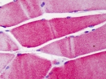 Immunohistochemistry (Formalin/PFA-fixed paraffin-embedded sections) - Anti-ACTN3 antibody - Loading Control (AB113234)
