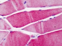 Immunohistochemistry (Formalin/PFA-fixed paraffin-embedded sections) - Anti-ACTN3 antibody - Loading Control (AB113234)