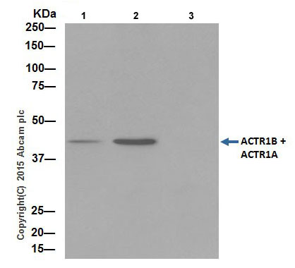 Immunoprecipitation - Anti-ACTR1B + ACTR1A antibody [EPR16968(B)] (AB203833), expandable thumbnail
