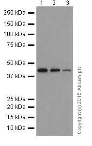 Western blot - Anti-ACTR1B + ACTR1A antibody [EPR16968(B)] (AB203833)