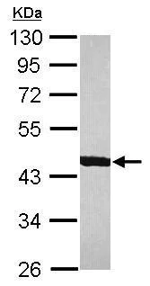 Western blot - Anti-ACTR1B antibody (AB227431)