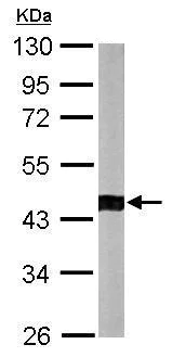Western blot - Anti-ACTR1B antibody (AB227431)