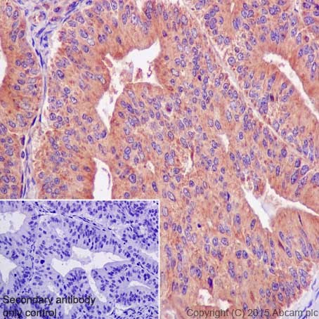 Immunohistochemistry (Formalin/PFA-fixed paraffin-embedded sections) - Anti-ACTR1B antibody [EPR16969] (AB203835), expandable thumbnail