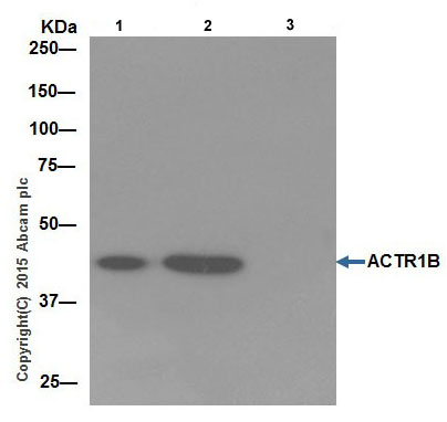 Immunoprecipitation - Anti-ACTR1B antibody [EPR16969] (ab203835), expandable thumbnail