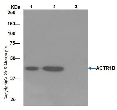 Immunoprecipitation - Anti-ACTR1B antibody [EPR16969] (AB203835)