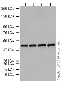 Western blot - Anti-ACTR1B antibody [EPR16969] (AB203835)