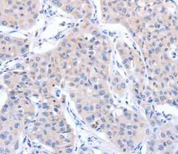 Immunohistochemistry (Formalin/PFA-fixed paraffin-embedded sections) - Anti-ACTR3B antibody (AB197812)