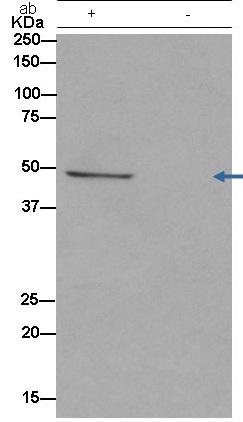 Immunoprecipitation - Anti-ACTR3B antibody [EPR14091] (AB182577)