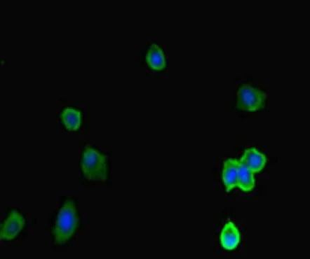 Immunocytochemistry/ Immunofluorescence - Anti-ACTR5 antibody (AB222967)