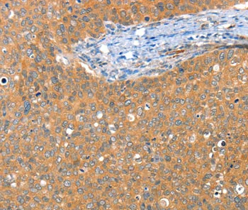 Immunohistochemistry (Formalin/PFA-fixed paraffin-embedded sections) - Anti-ACY3 antibody (AB197799)
