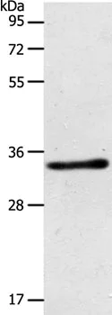 Western blot - Anti-ACY3 antibody (AB197799)