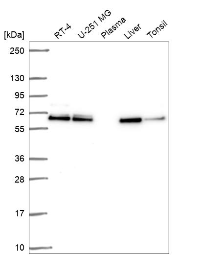 Western blot - Anti-acyl-CoA Thioesterase 2 antibody (AB254958)