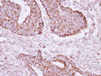 Immunohistochemistry (Formalin/PFA-fixed paraffin-embedded sections) - Anti-Acyl-CoA Thioesterase 9 antibody (AB127018)