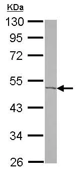 Western blot - Anti-Acyl-CoA Thioesterase 9 antibody (AB127018)