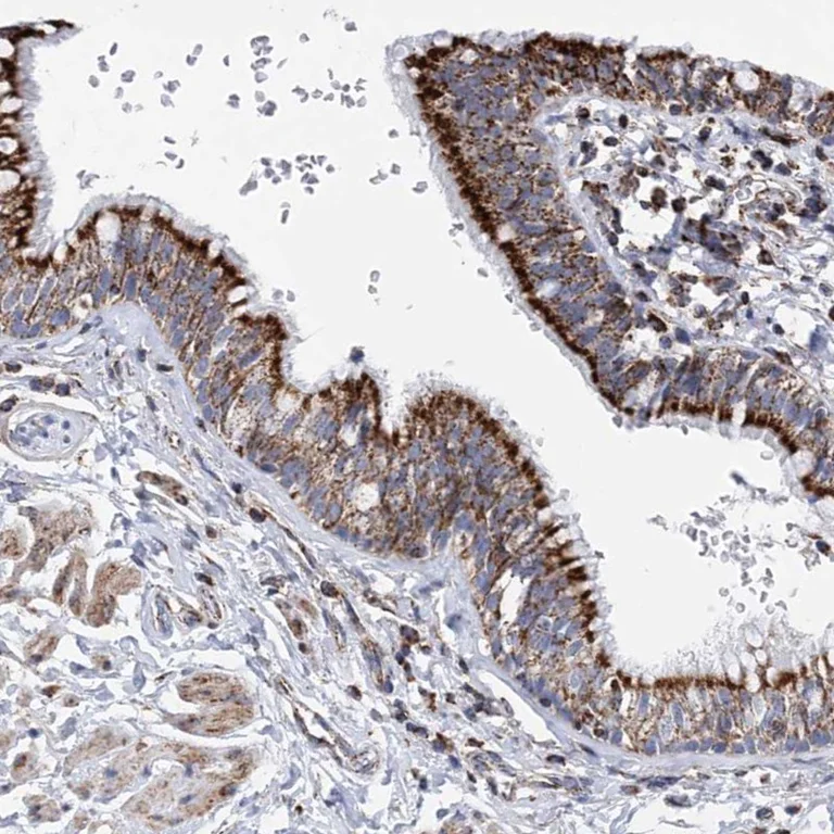 Immunohistochemistry (Formalin/PFA-fixed paraffin-embedded sections) - Anti-Acyl-CoA Thioesterase 9 antibody (AB252978)
