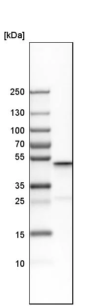 Western blot - Anti-Acyl-CoA Thioesterase 9 antibody (AB252978)