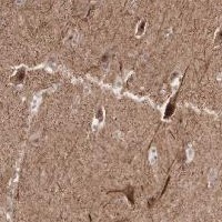 Immunohistochemistry (Formalin/PFA-fixed paraffin-embedded sections) - Anti-Acyl-coenzyme A Thioesterase 4 antibody (AB121116), expandable thumbnail
