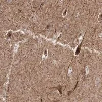 Immunohistochemistry (Formalin/PFA-fixed paraffin-embedded sections) - Anti-Acyl-coenzyme A Thioesterase 4 antibody (AB121116)