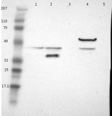Western blot - Anti-Acyl-coenzyme A Thioesterase 4 antibody (AB121116), expandable thumbnail