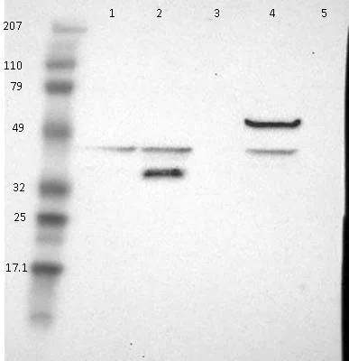 Western blot - Anti-Acyl-coenzyme A Thioesterase 4 antibody (AB121116)