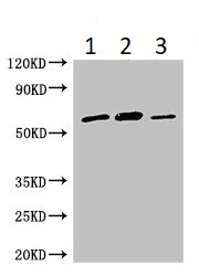 Western blot - Anti-Acyloxyacyl Hydrolase antibody (AB222913)