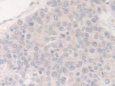Immunohistochemistry (Formalin/PFA-fixed paraffin-embedded sections) - Anti-Acyloxyacyl Hydrolase antibody (AB233405)