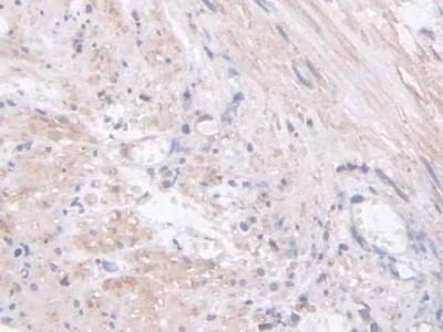 Immunohistochemistry (Formalin/PFA-fixed paraffin-embedded sections) - Anti-Acyloxyacyl Hydrolase antibody (AB233405)