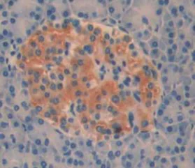 Immunohistochemistry (Formalin/PFA-fixed paraffin-embedded sections) - Anti-Acyloxyacyl Hydrolase antibody (AB233405)