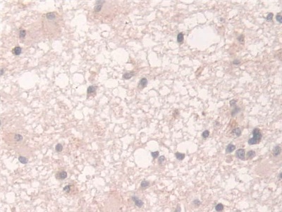 Immunohistochemistry (Formalin/PFA-fixed paraffin-embedded sections) - Anti-Acyloxyacyl Hydrolase antibody (AB233405)