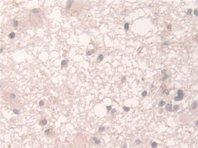 Immunohistochemistry (Formalin/PFA-fixed paraffin-embedded sections) - Anti-Acyloxyacyl Hydrolase antibody (AB233405)