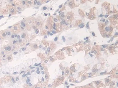 Immunohistochemistry (Formalin/PFA-fixed paraffin-embedded sections) - Anti-Acyloxyacyl Hydrolase antibody (AB233405)