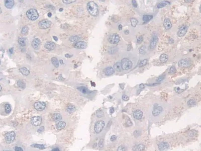 Immunohistochemistry (Formalin/PFA-fixed paraffin-embedded sections) - Anti-Acyloxyacyl Hydrolase antibody (AB233405)