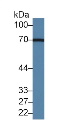 Western blot - Anti-Acyloxyacyl Hydrolase antibody (AB233405)