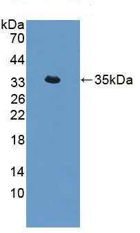 Western blot - Anti-Acyloxyacyl Hydrolase antibody (AB233405)