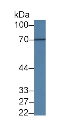 Western blot - Anti-Acyloxyacyl Hydrolase antibody (AB233405)