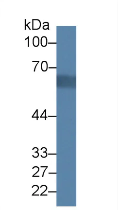 Western blot - Anti-Acyloxyacyl Hydrolase antibody (AB233405)