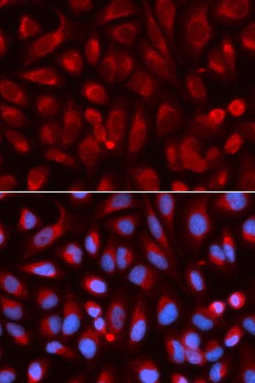 Immunocytochemistry/ Immunofluorescence - Anti-ADA antibody (AB175310)