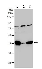 Western blot - Anti-ADA antibody (AB183631)