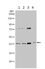 Western blot - Anti-ADA antibody (AB183631)