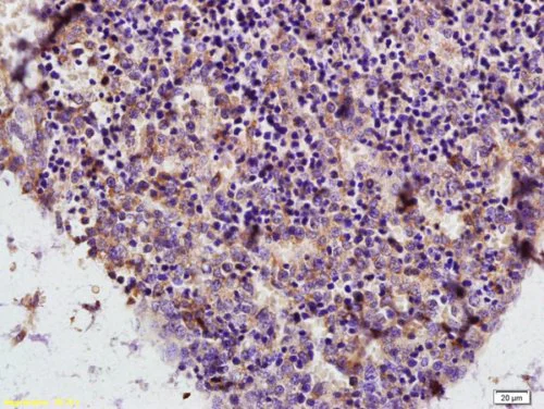 Immunohistochemistry (Formalin/PFA-fixed paraffin-embedded sections) - Anti-ADA antibody (AB217846)