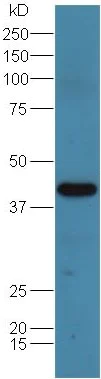 Western blot - Anti-ADA antibody (AB217846)