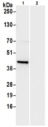 Immunoprecipitation - Anti-ADA antibody (AB226395)