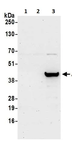 Western blot - Anti-ADA antibody (AB226395)